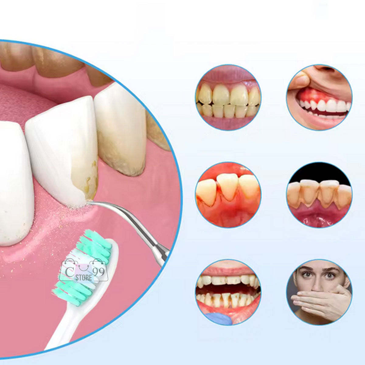 Cepillo De Dientes y Eliminador De sarro