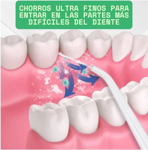 Irrigador oral Limpia Max:😮‍💨 ¡Elimina en segundos el mal aliento y los restos de comida!