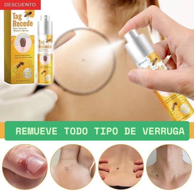 🛑 ¿Verrugas incómodas? El veneno de abeja las elimina sin dolor