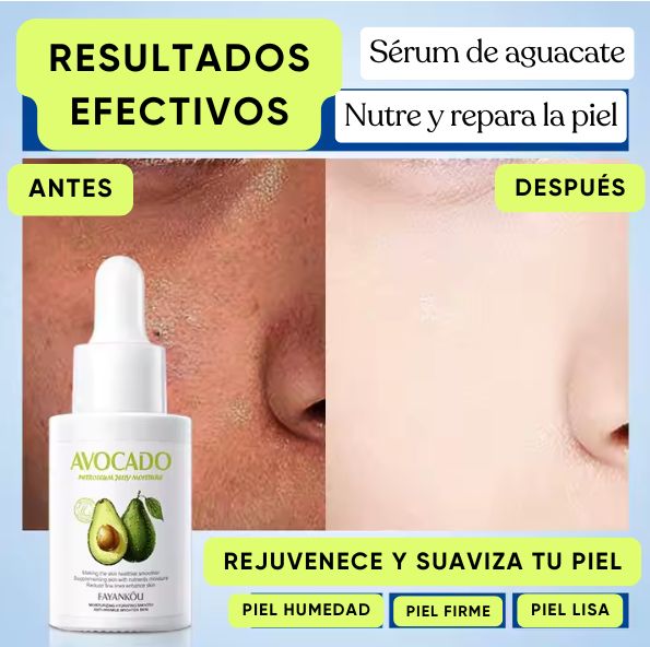 Sérum antiarrugas: ¡Nutre tu piel con el poder del aguacate!