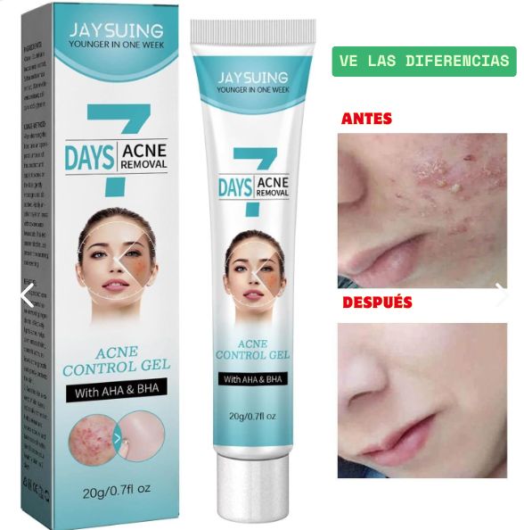 Crema facial SIN acné: !Piel limpia y suave!